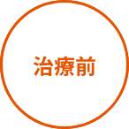 治療前