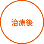 治療後